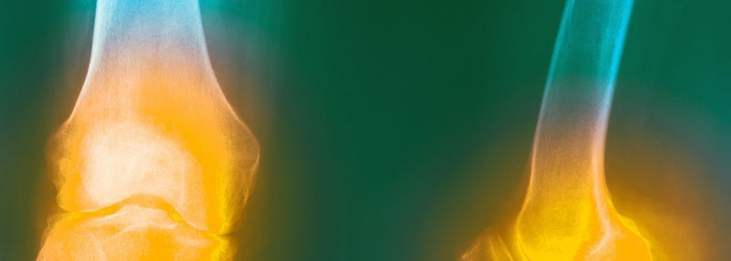 Menopause and joint pain: causes and remedies