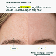 Smart Collagen 10g Shot - Insentials