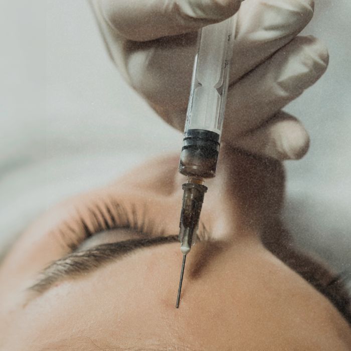 Langetermijneffect botox