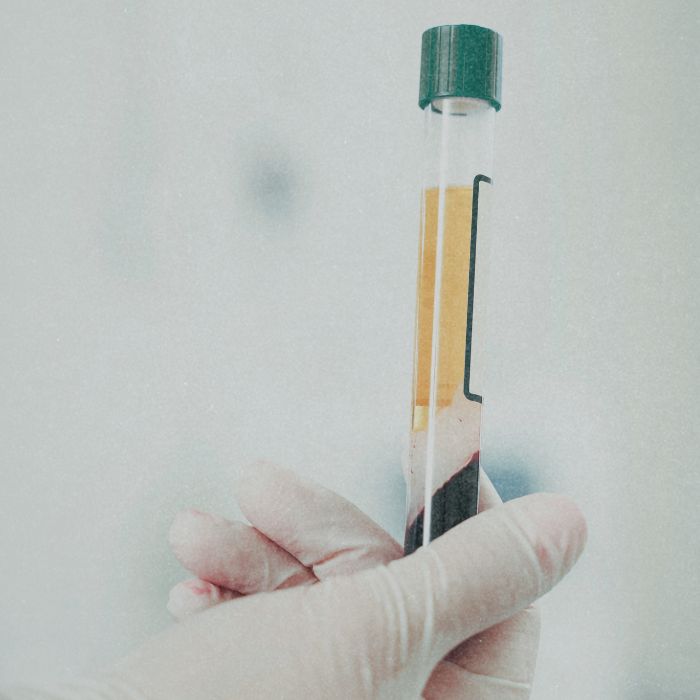 Prp anti aging